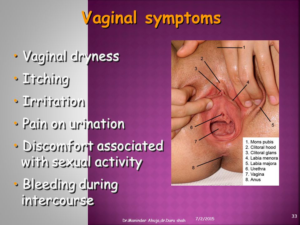 Normal Vs Abnormal Vaginal Discharge