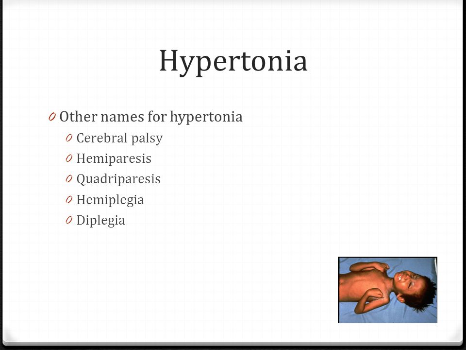 hypertonia causes)