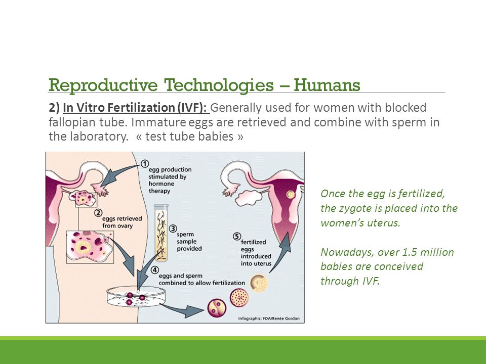 2) In Vitro Fertilization (IVF): Generally used for women with blocked fallopian tube.