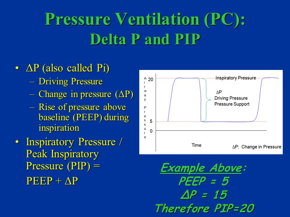Mechanical Ventilation Julie Warren, RN, MSN, CCRN Pediatric CNS  12/2012-current. - ppt download