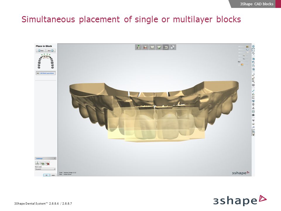 3Shape Dental System™ / Simultaneous placement of single or multilayer blocks 3Shape CAD blocks