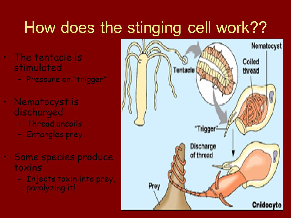 How does the stinging cell work .