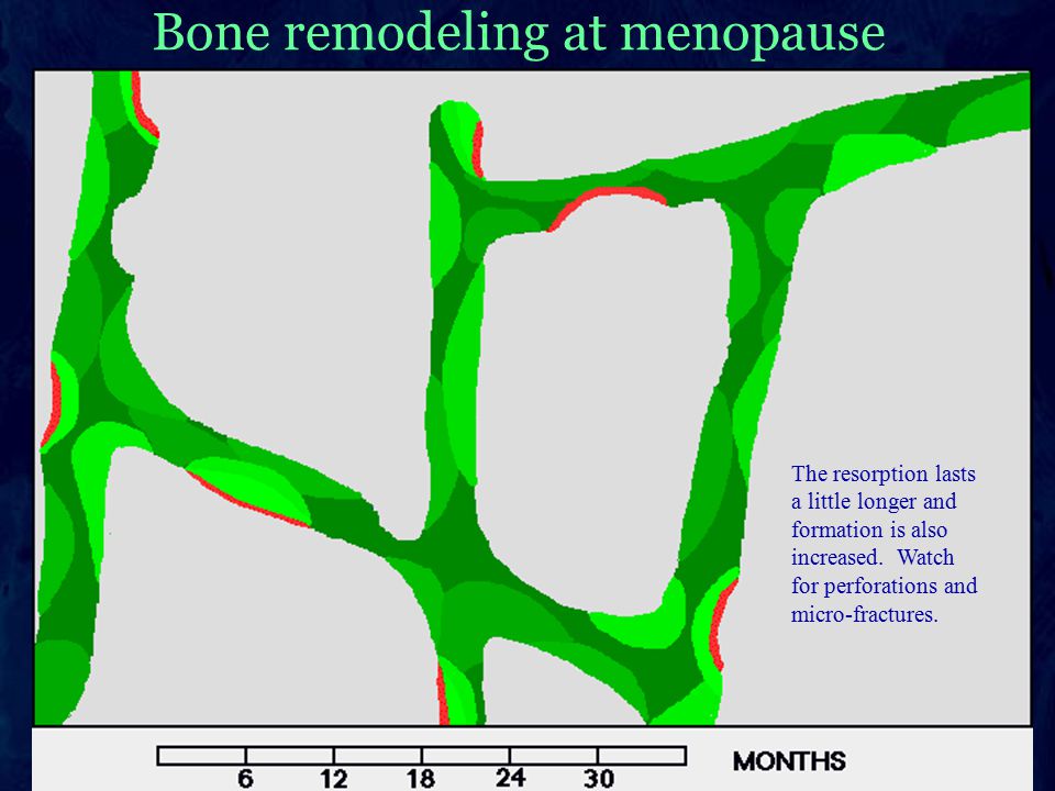 Bone remodeling animations This is a series. The first slide will be a  still shot of the first frame, and the next will be the rest of the  animation. Susan. - ppt
