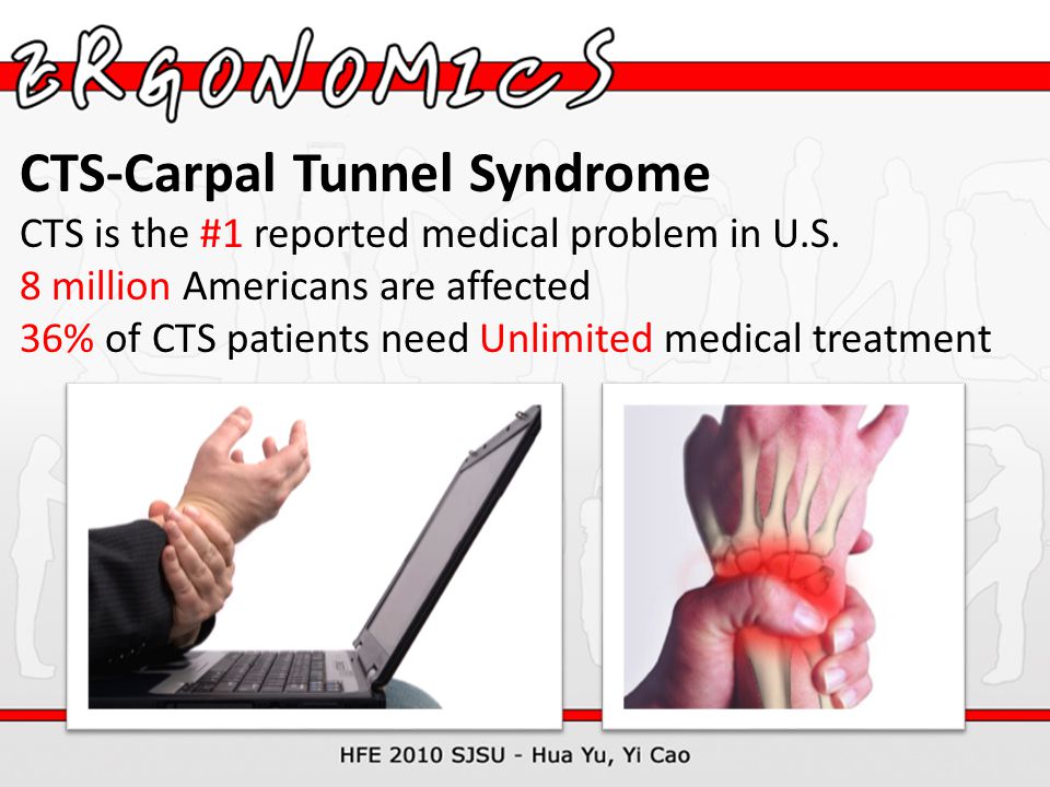 CTS-Carpal Tunnel Syndrome CTS is the #1 reported medical problem in U.S.
