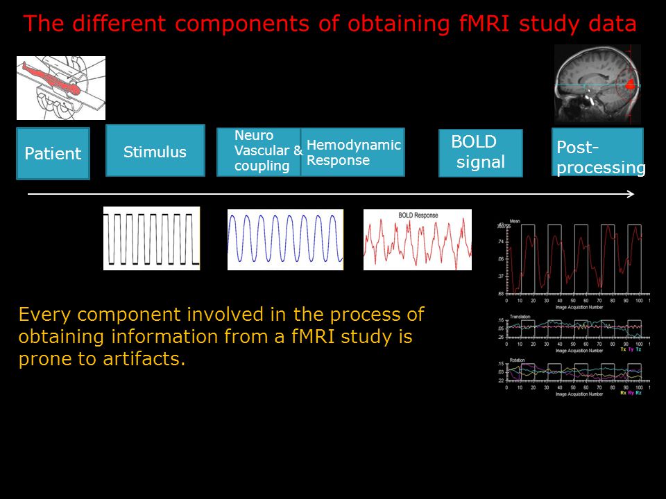 Patient Stimulus Neuro Vascular & coupling Hemodynamic Response BOLD signal Post- processing The different components of obtaining fMRI study data Every component involved in the process of obtaining information from a fMRI study is prone to artifacts.