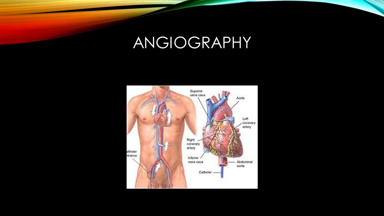 ANGIOGRAPHY