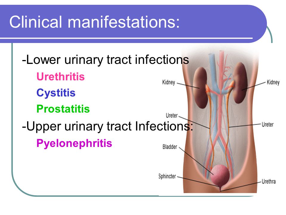 is prostatitis a urinary tract infection Prosztata gyertyák diclofenak