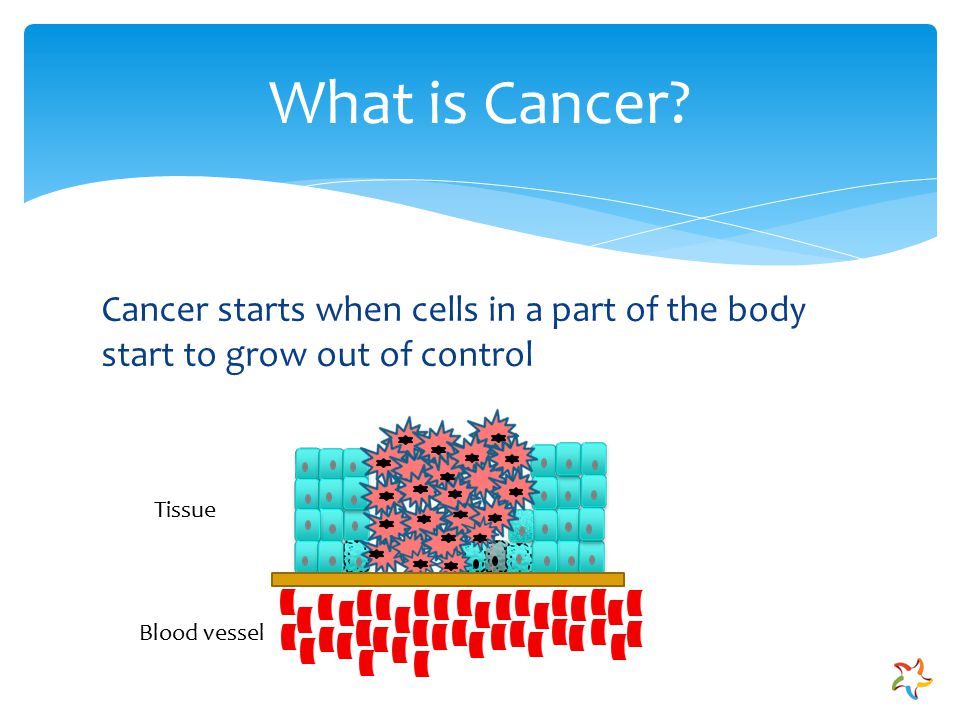 Cancer starts when cells in a part of the body start to grow out of control What is Cancer.