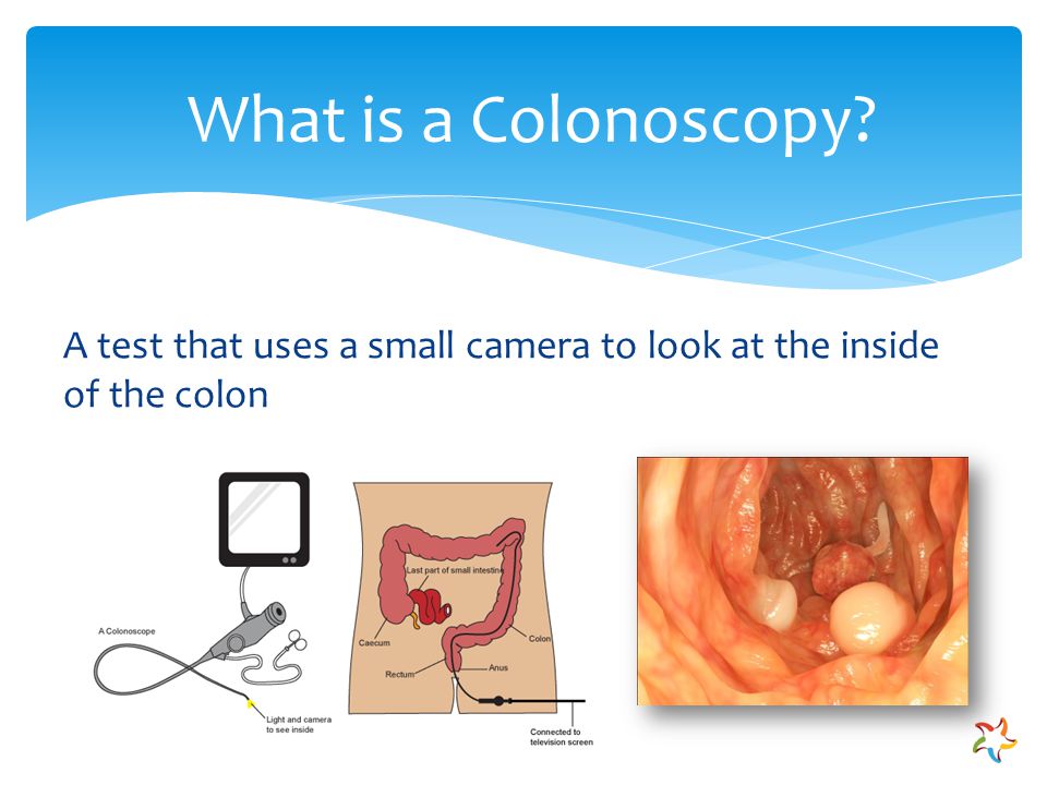 A test that uses a small camera to look at the inside of the colon What is a Colonoscopy