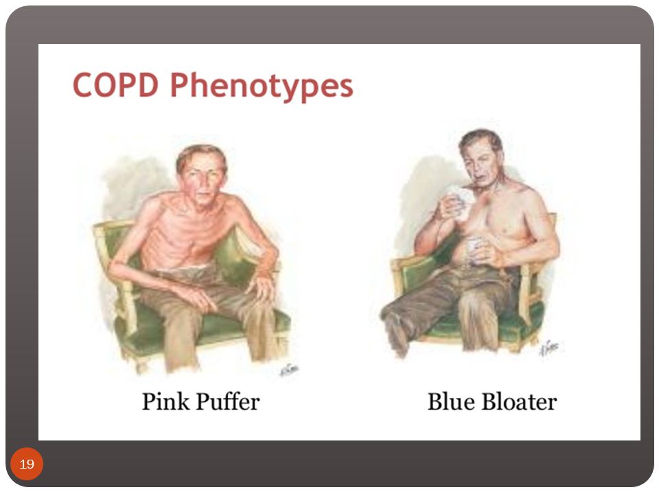 CHRONIC OBSTRUCTIVE PULMONARY DISEASE [COPD] - ppt video online download