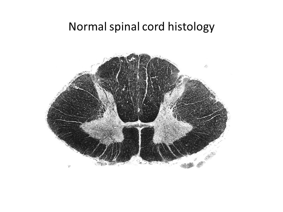 Normal spinal cord histology