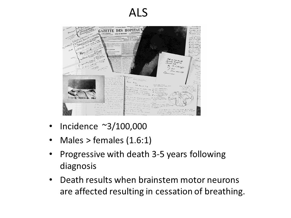 ALS Incidence ~3/100,000 Males > females (1.6:1) Progressive with death 3-5 years following diagnosis Death results when brainstem motor neurons are affected resulting in cessation of breathing.