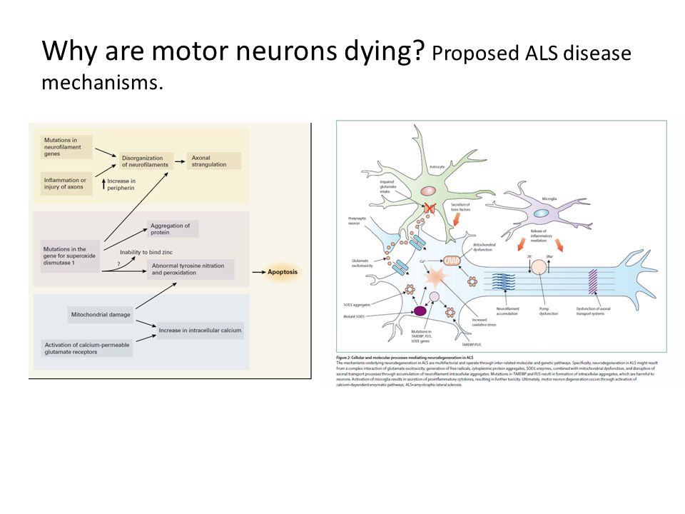 Why are motor neurons dying Proposed ALS disease mechanisms.