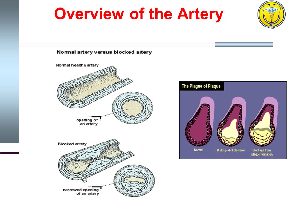 Overview of the Artery