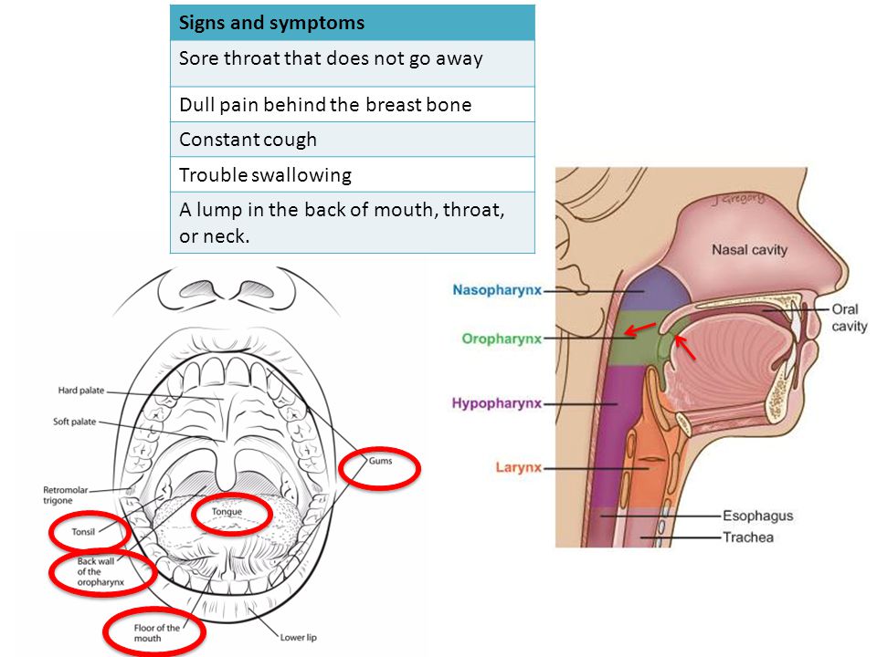hpv and neck lumps)