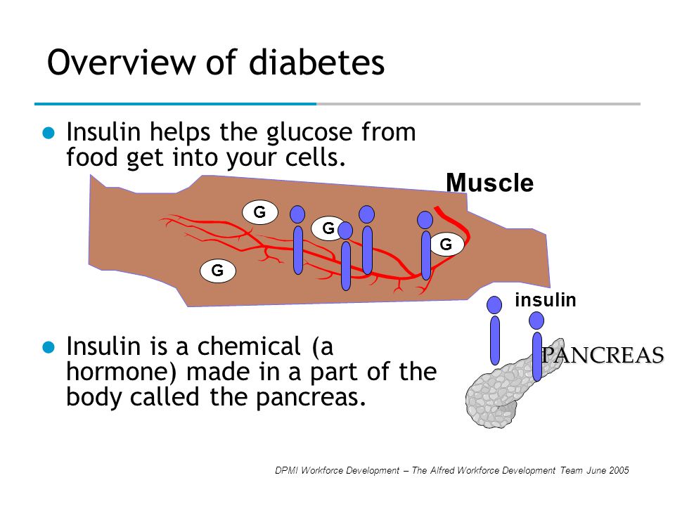 DPMI Workforce Development – The Alfred Workforce Development Team June 2005 Overview of diabetes Insulin helps the glucose from food get into your cells.