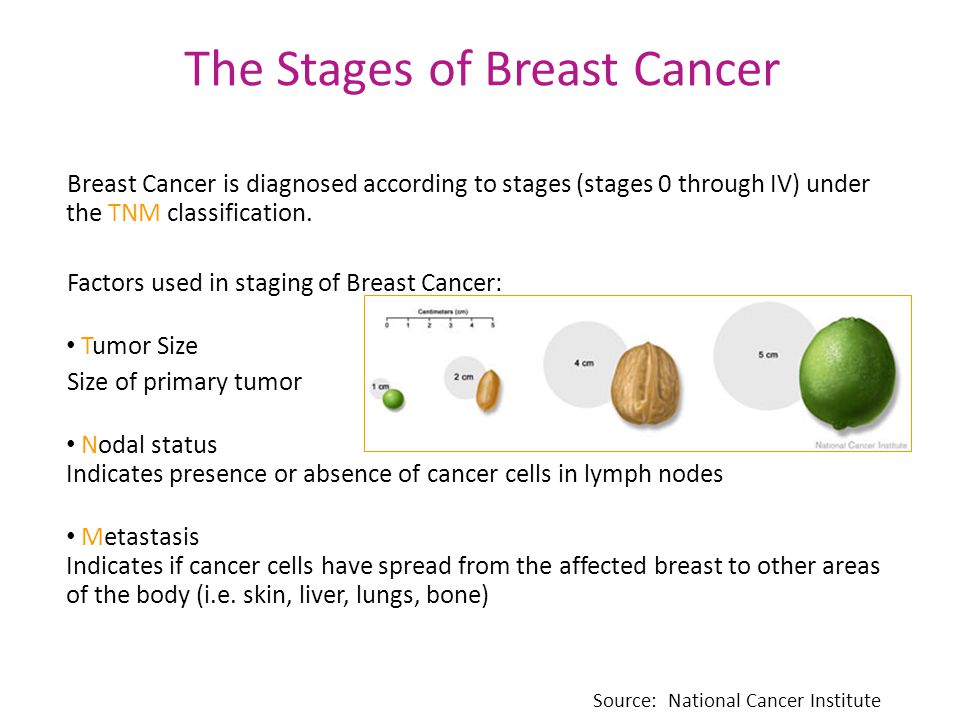 The Stages of Breast Cancer Breast Cancer is diagnosed according to stages (stages 0 through IV) under the TNM classification.