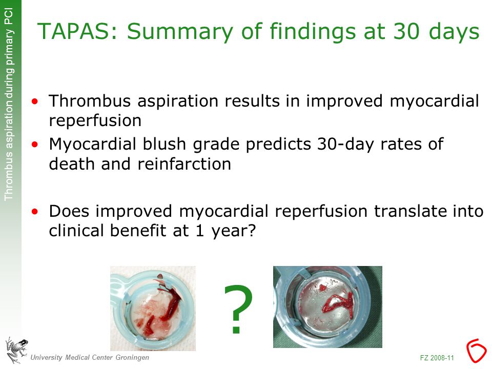 University Medical Center Groningen Thrombus aspiration during primary PCI FZ TAPAS: Summary of findings at 30 days Thrombus aspiration results in improved myocardial reperfusion Myocardial blush grade predicts 30-day rates of death and reinfarction Does improved myocardial reperfusion translate into clinical benefit at 1 year.