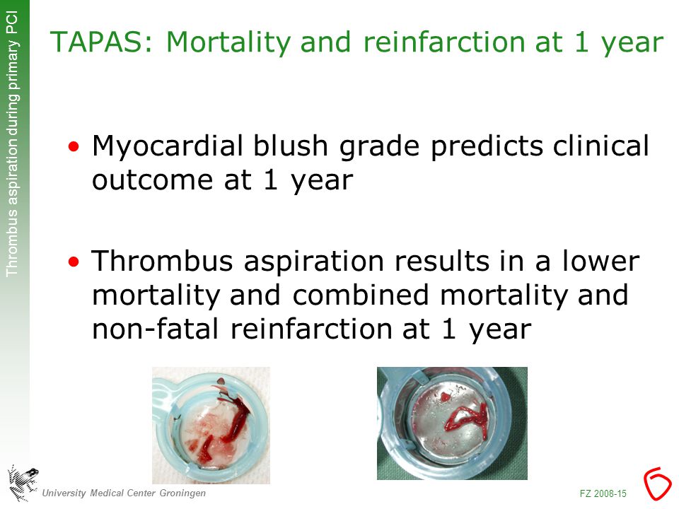 University Medical Center Groningen Thrombus aspiration during primary PCI FZ TAPAS: Mortality and reinfarction at 1 year Myocardial blush grade predicts clinical outcome at 1 year Thrombus aspiration results in a lower mortality and combined mortality and non-fatal reinfarction at 1 year