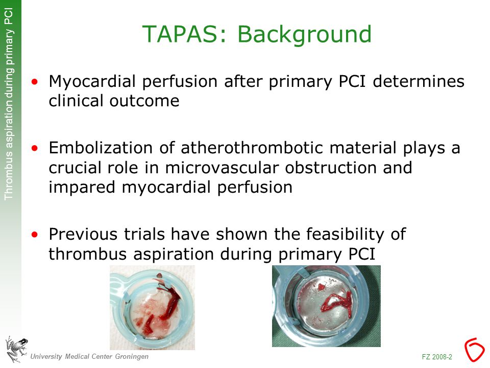University Medical Center Groningen Thrombus aspiration during primary PCI FZ TAPAS: Background Myocardial perfusion after primary PCI determines clinical outcome Embolization of atherothrombotic material plays a crucial role in microvascular obstruction and impared myocardial perfusion Previous trials have shown the feasibility of thrombus aspiration during primary PCI