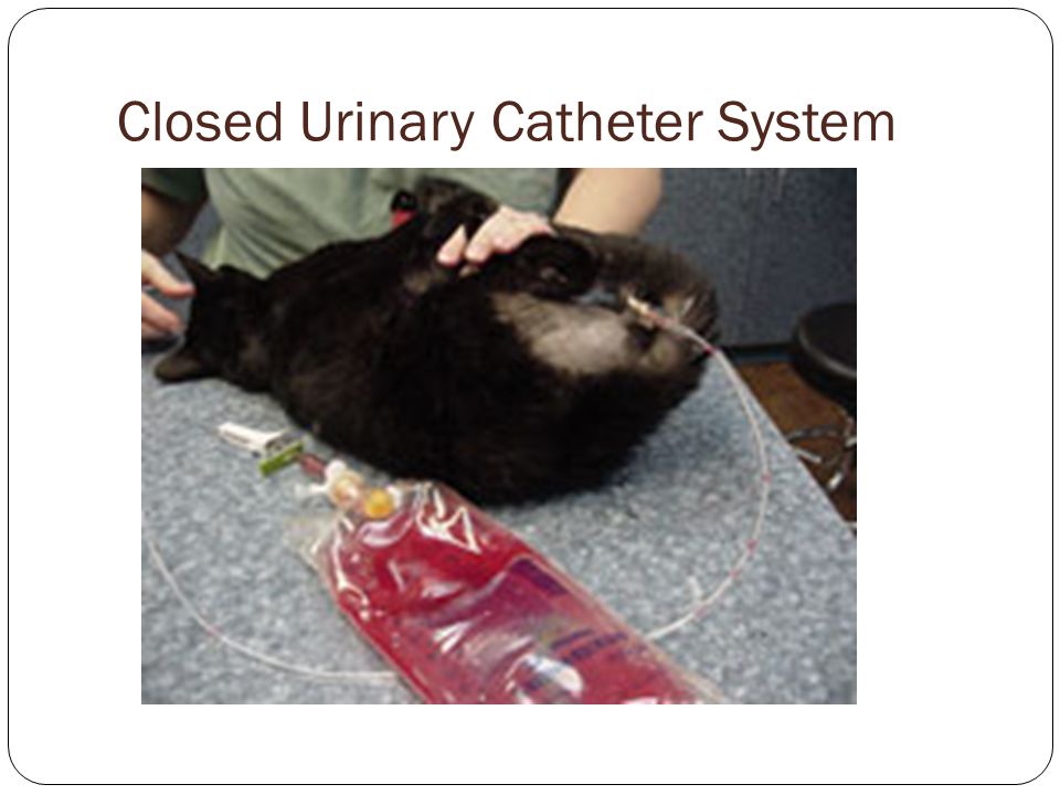 Closed Urinary Catheter System