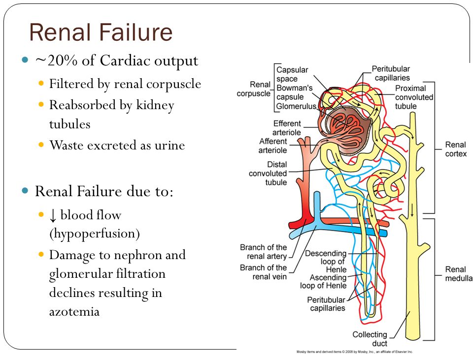 Renal Failure ~20% of Cardiac output Filtered by renal corpuscle Reabsorbed by kidney tubules Waste excreted as urine Renal Failure due to: ↓ blood flow (hypoperfusion) Damage to nephron and glomerular filtration declines resulting in azotemia