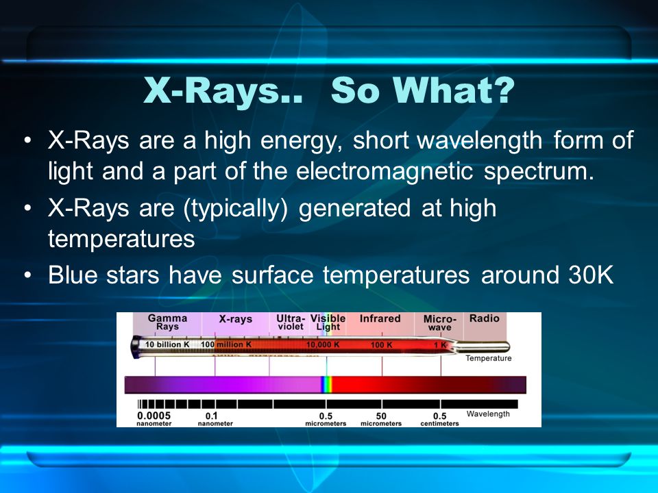 X-Rays.. So What.