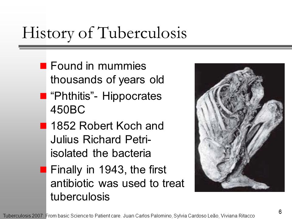 Tuberculosis Sandra Ferreira. Agenda What is Tuberculosis History of Treatment Our Immune Response PA-824 Conclusions ppt download