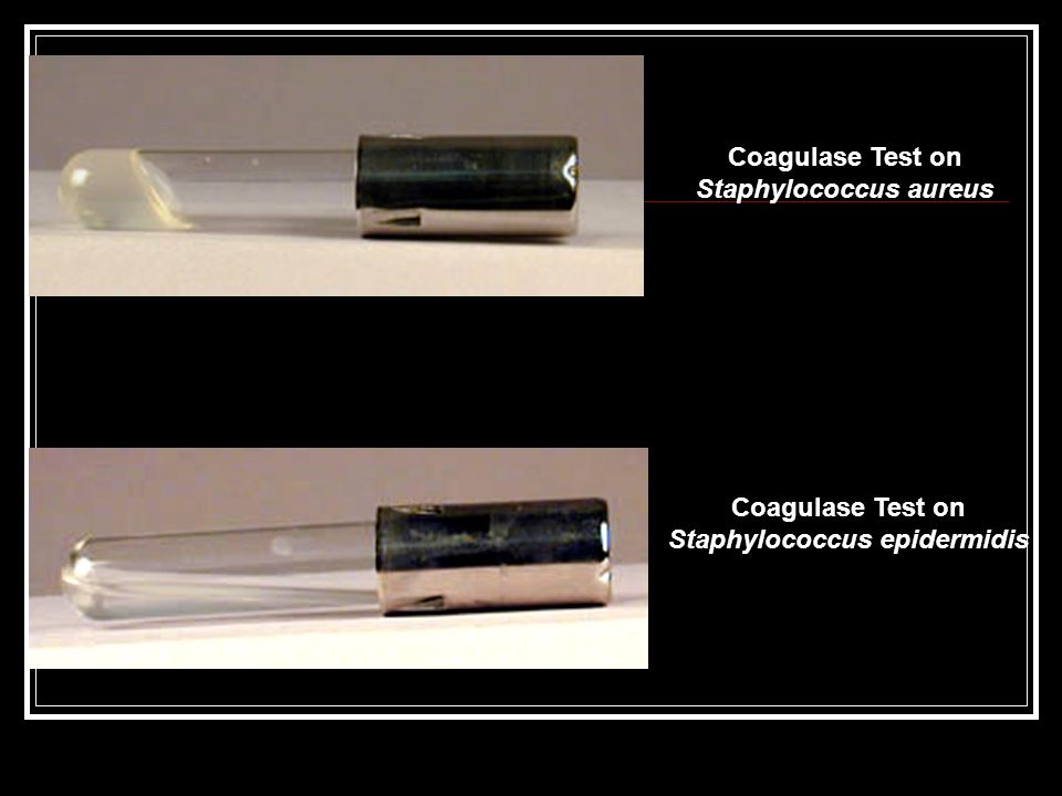 Coagulase Test on Staphylococcus aureus Coagulase Test on Staphylococcus epidermidis