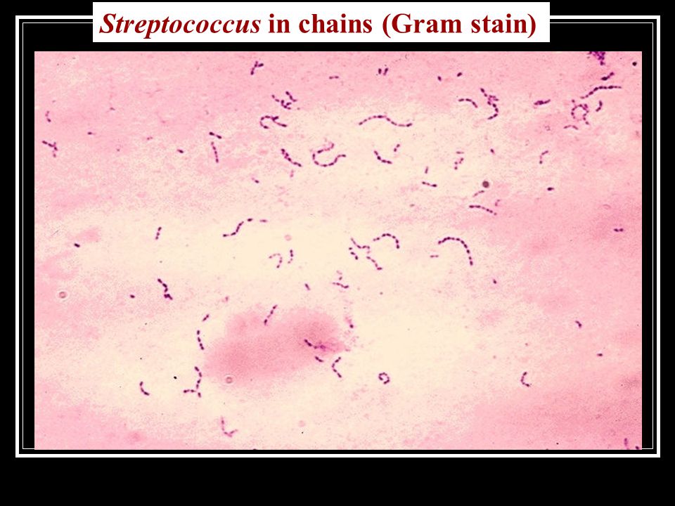 Streptococcus in chains (Gram stain)