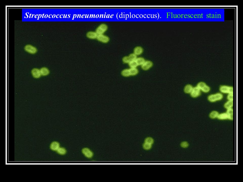 Streptococcus pneumoniae (diplococcus). Fluorescent stain