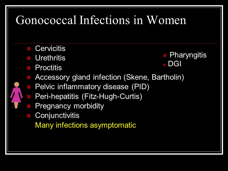 Gonococcal Infections in Women Cervicitis Urethritis Proctitis Accessory gland infection (Skene, Bartholin) Pelvic inflammatory disease (PID) Peri-hepatitis (Fitz-Hugh-Curtis) Pregnancy morbidity Conjunctivitis Many infections asymptomatic n Pharyngitis n DGI