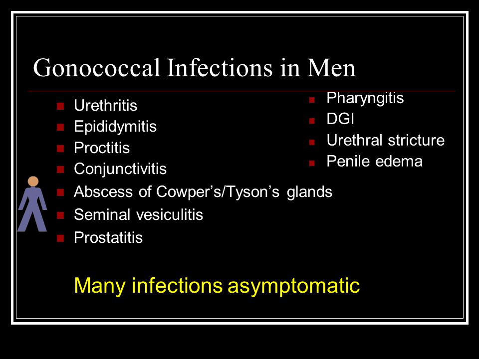 Gonococcal Infections in Men Urethritis Epididymitis Proctitis Conjunctivitis Abscess of Cowper’s/Tyson’s glands Seminal vesiculitis Prostatitis Many infections asymptomatic Pharyngitis DGI Urethral stricture Penile edema