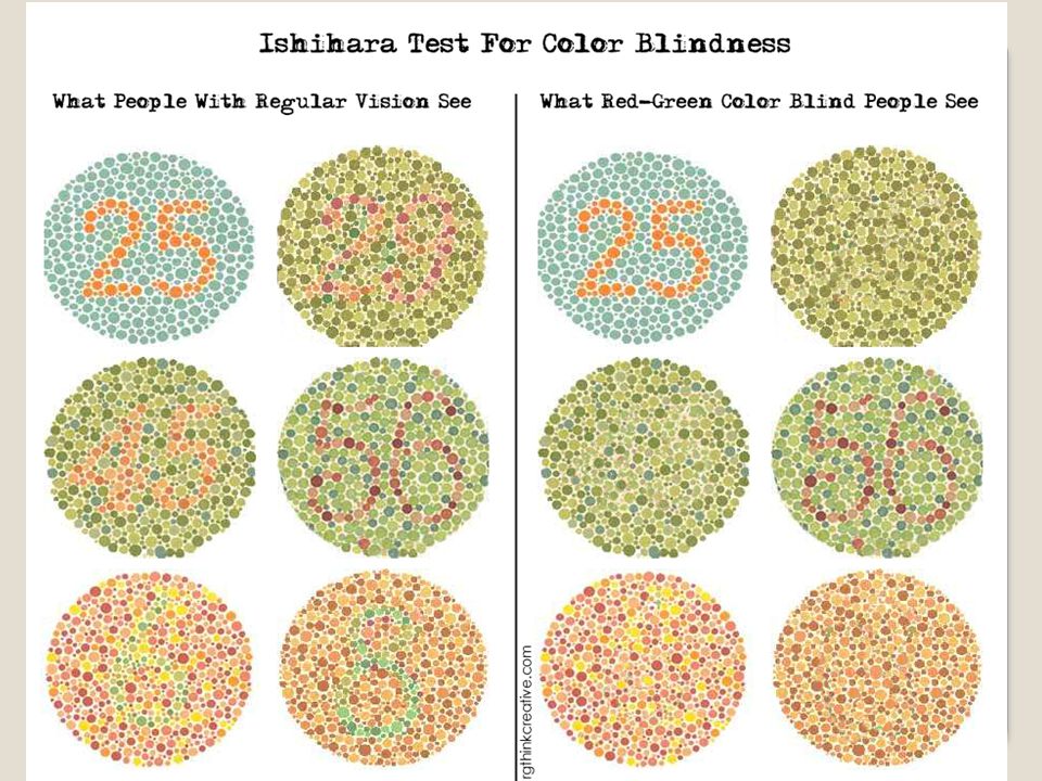The Basics Color blindness is a very common disorder, and is also known as Color...