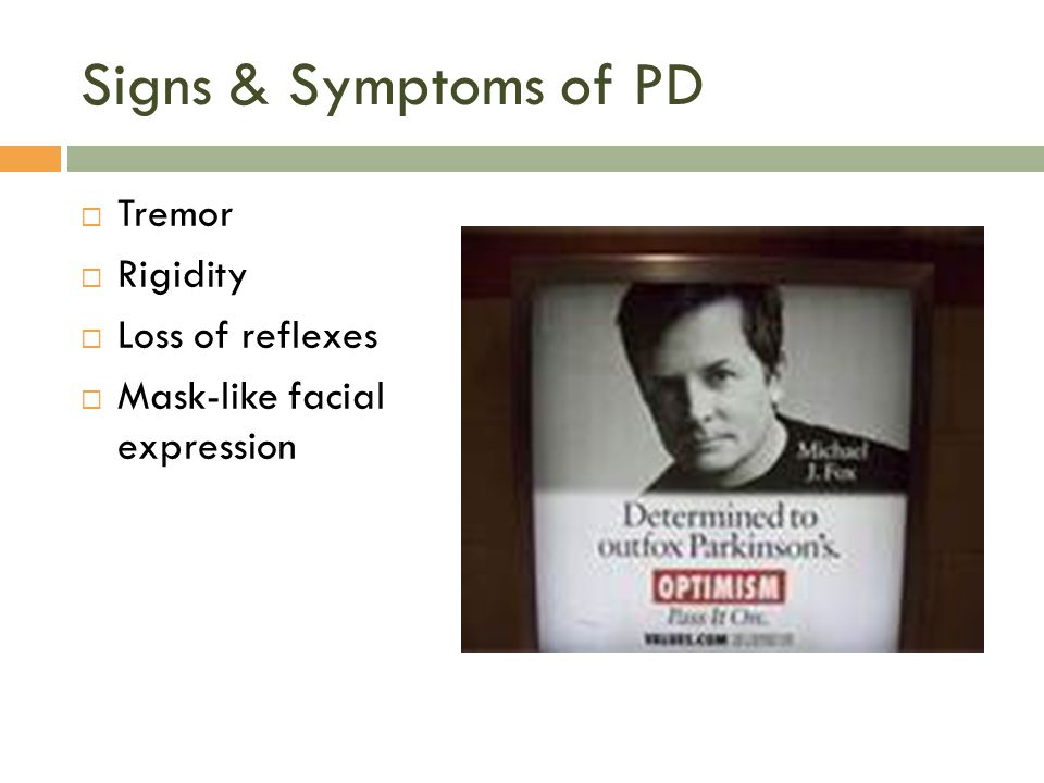 Signs & Symptoms of PD  Tremor  Rigidity  Loss of reflexes  Mask-like facial expression
