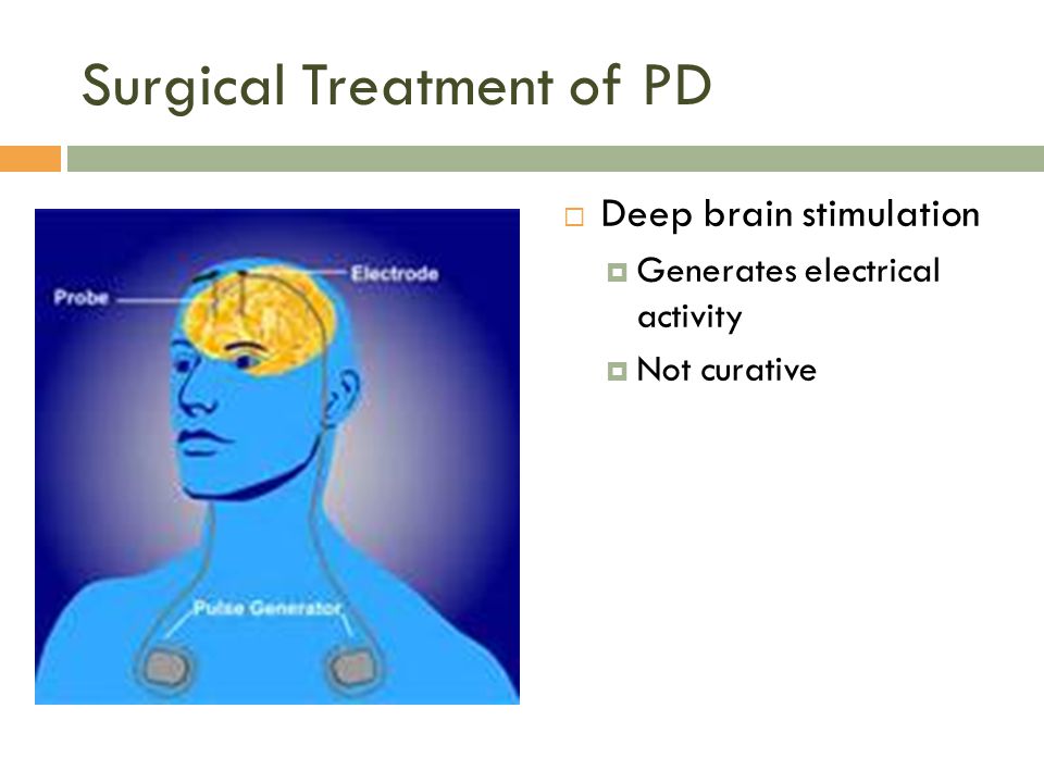 Surgical Treatment of PD  Deep brain stimulation  Generates electrical activity  Not curative