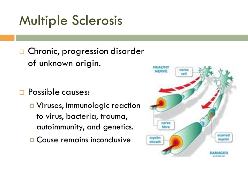  Chronic, progression disorder of unknown origin.