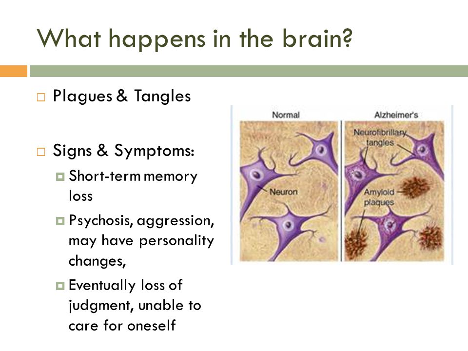 What happens in the brain.