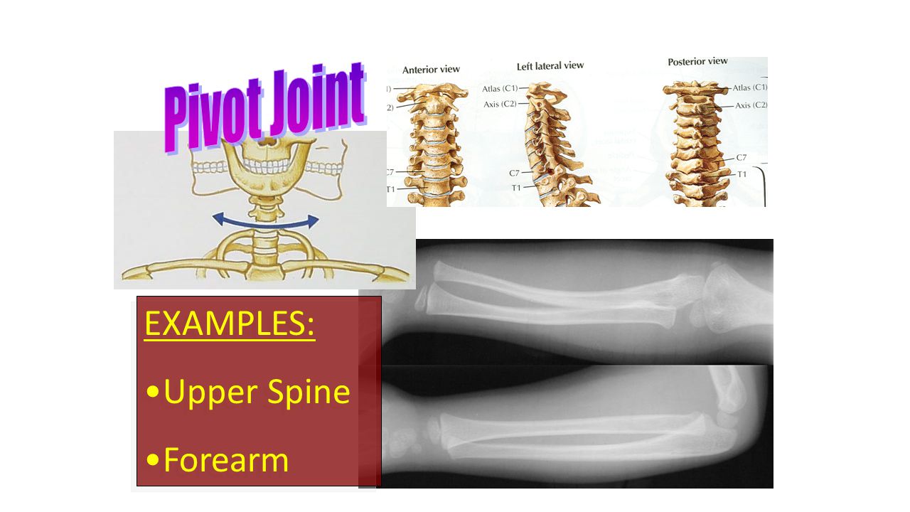 EXAMPLES: Upper Spine Forearm EXAMPLES: Upper Spine Forearm