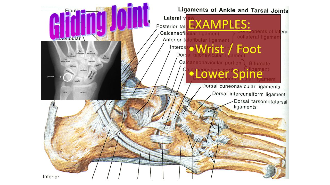 EXAMPLES: Wrist / Foot Lower Spine EXAMPLES: Wrist / Foot Lower Spine