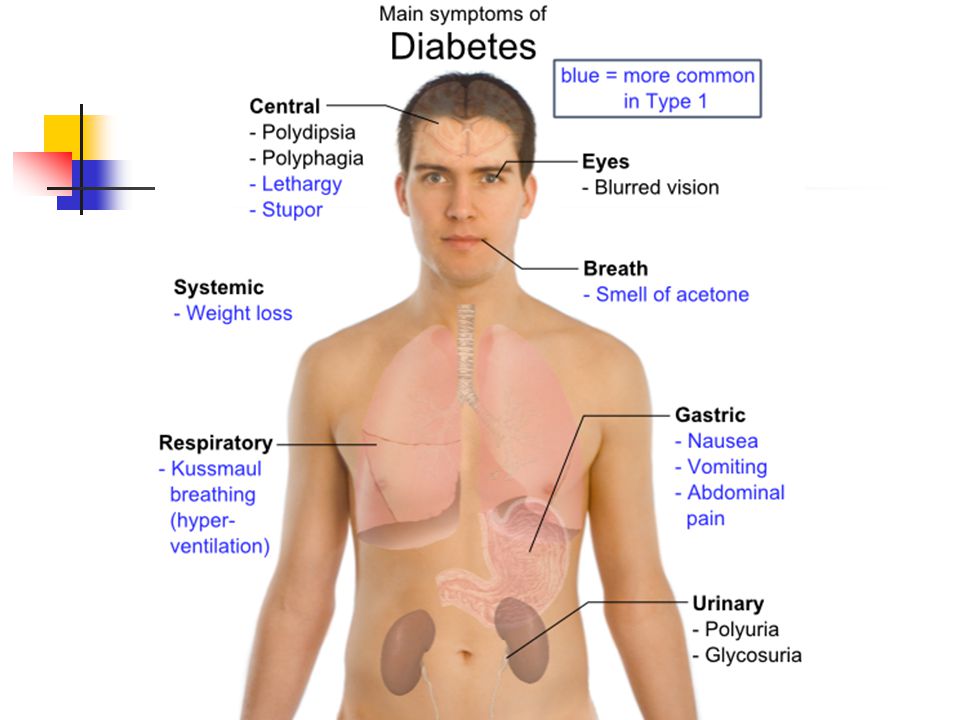 Признаки диабета у мужчин после 40 первые. Проявления сахарного диабета у мужчин. Мононуклеоз крапивница. Начальные симптомы диабета.