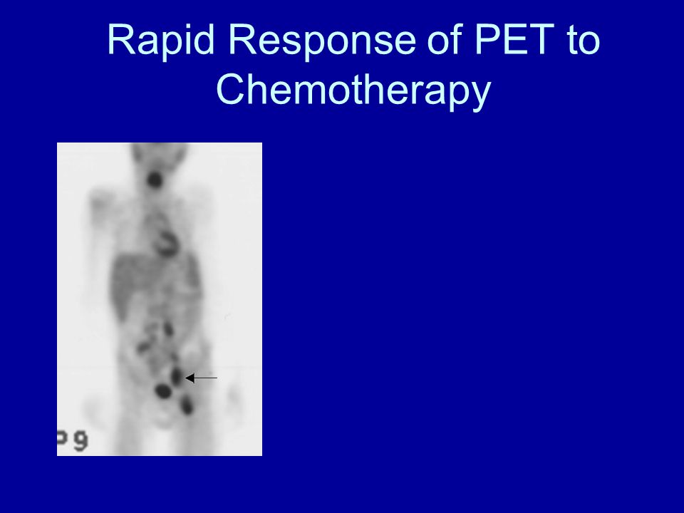 Rapid Response of PET to Chemotherapy
