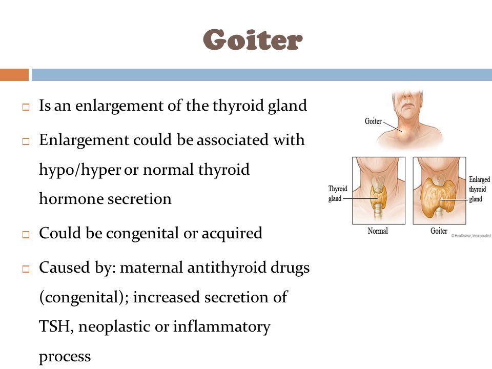 Goiter  Is an enlargement of the thyroid gland  Enlargement could be associated with hypo/hyper or normal thyroid hormone secretion  Could be congenital or acquired  Caused by: maternal antithyroid drugs (congenital); increased secretion of TSH, neoplastic or inflammatory process