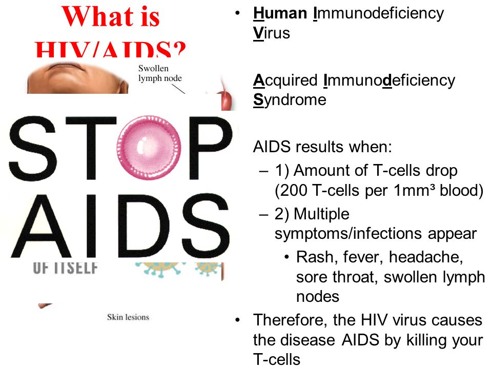 How is HIV contracted.