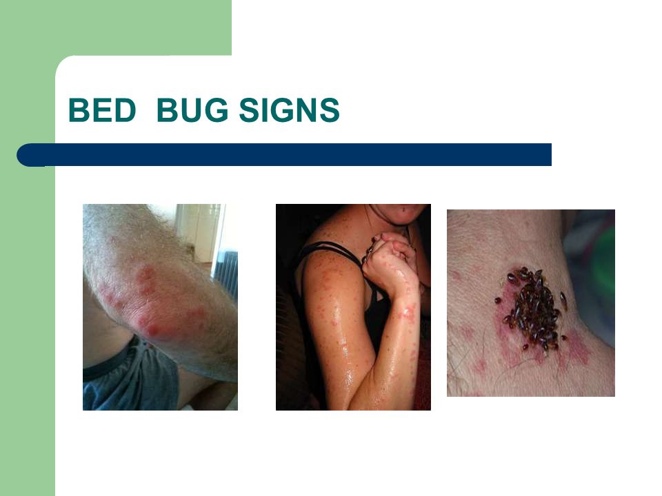 BED BUG SIGNS