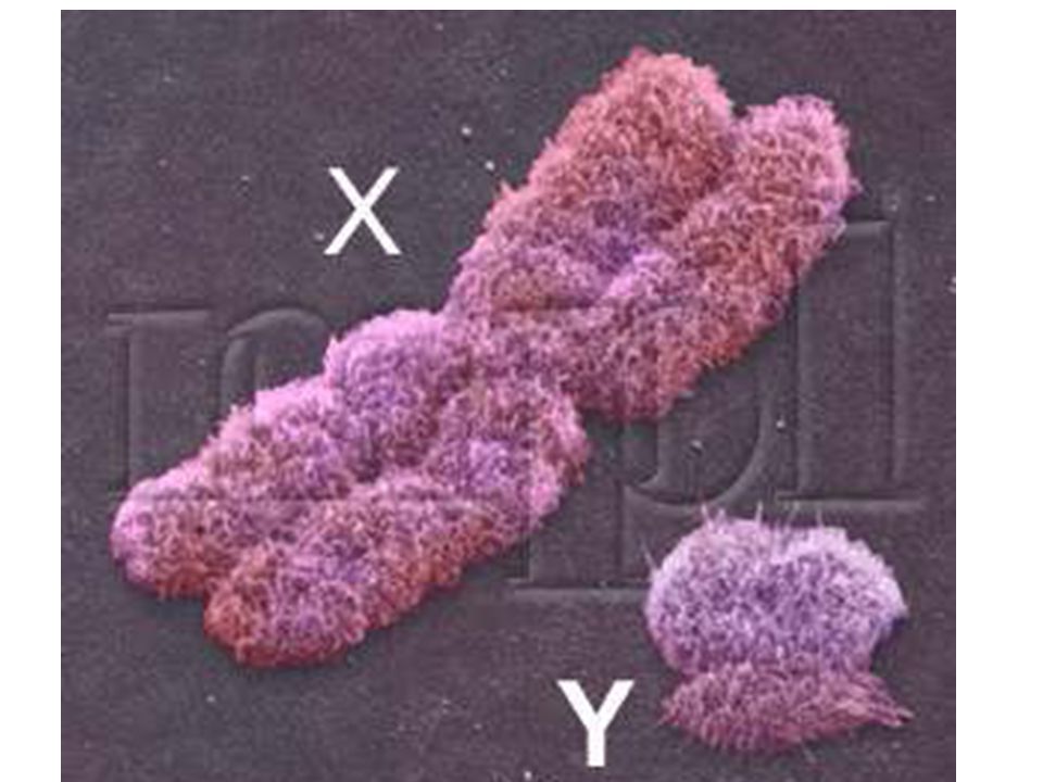 Хромосомы лучше видны. Икс хромосома и Игрек хромосома. Хромосомы в микроскопе. Хромосомы под микроскопом. Х Y хромосомы.
