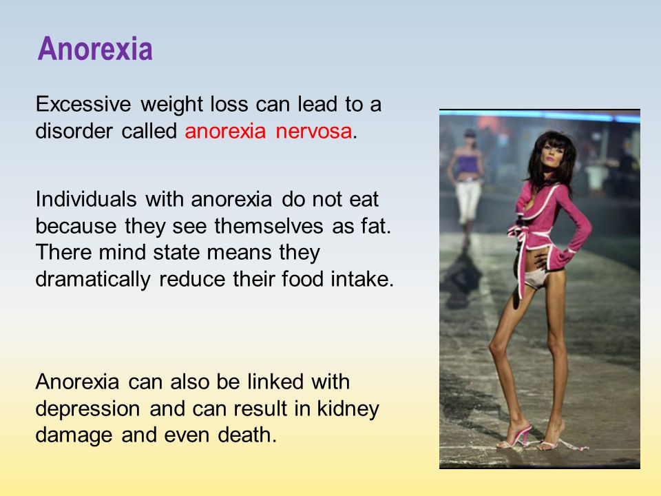Anorexia Excessive weight loss can lead to a disorder called anorexia nervosa.