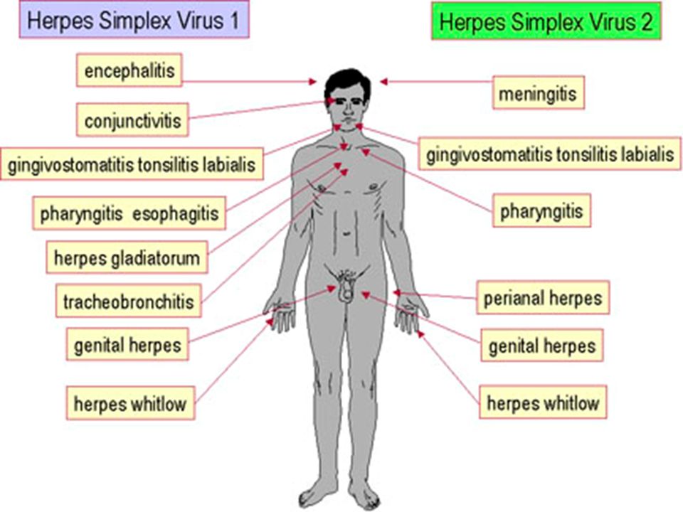 Presentation on theme: "HERPESVIRUSES Properties of herpesviruses Enve...