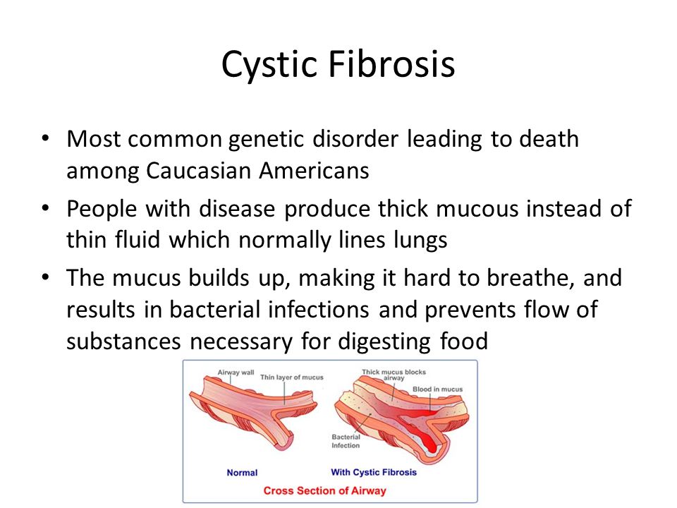 Cystic Fibrosis Most common genetic disorder leading to death among Caucasian Americans People with disease produce thick mucous instead of thin fluid which normally lines lungs The mucus builds up, making it hard to breathe, and results in bacterial infections and prevents flow of substances necessary for digesting food