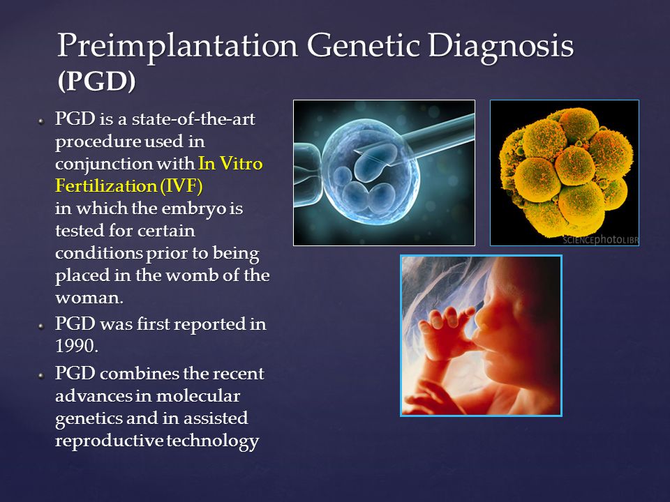 Preimplantation Genetic Diagnosis (PGD) PGD is a